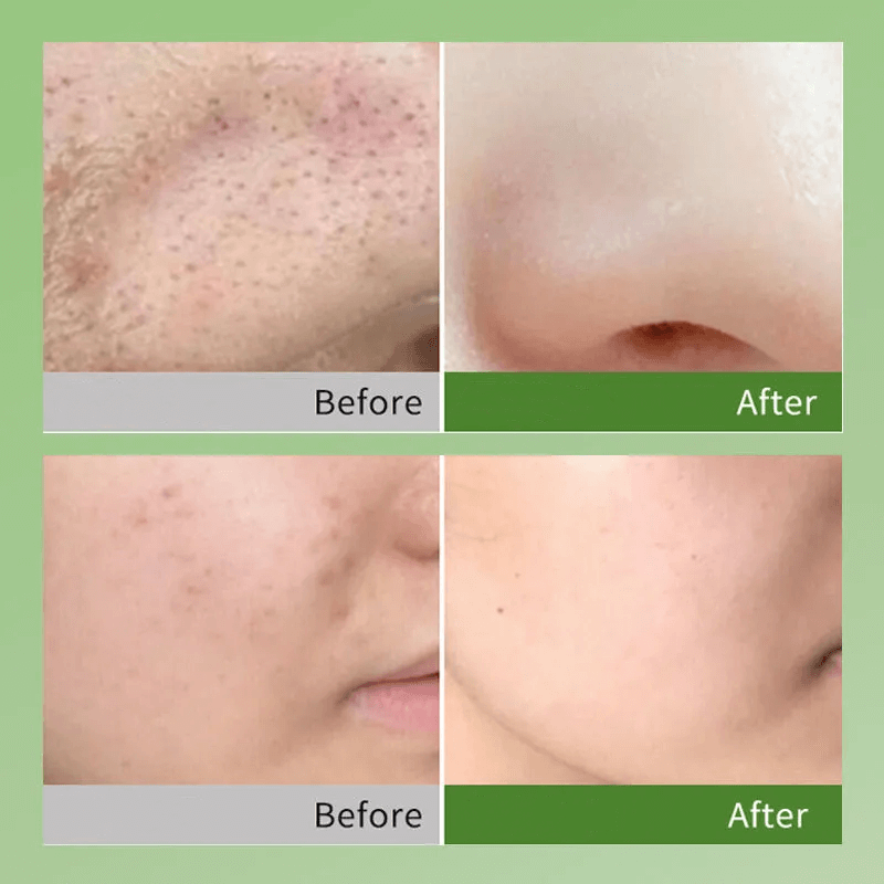 Composite Sour Avocado Bubble Fruit Mask