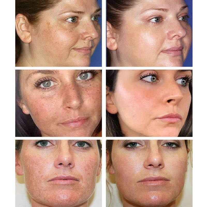 Shrink Pores Whitening Cream Oil Skin Face Treatment Moisturizing Care