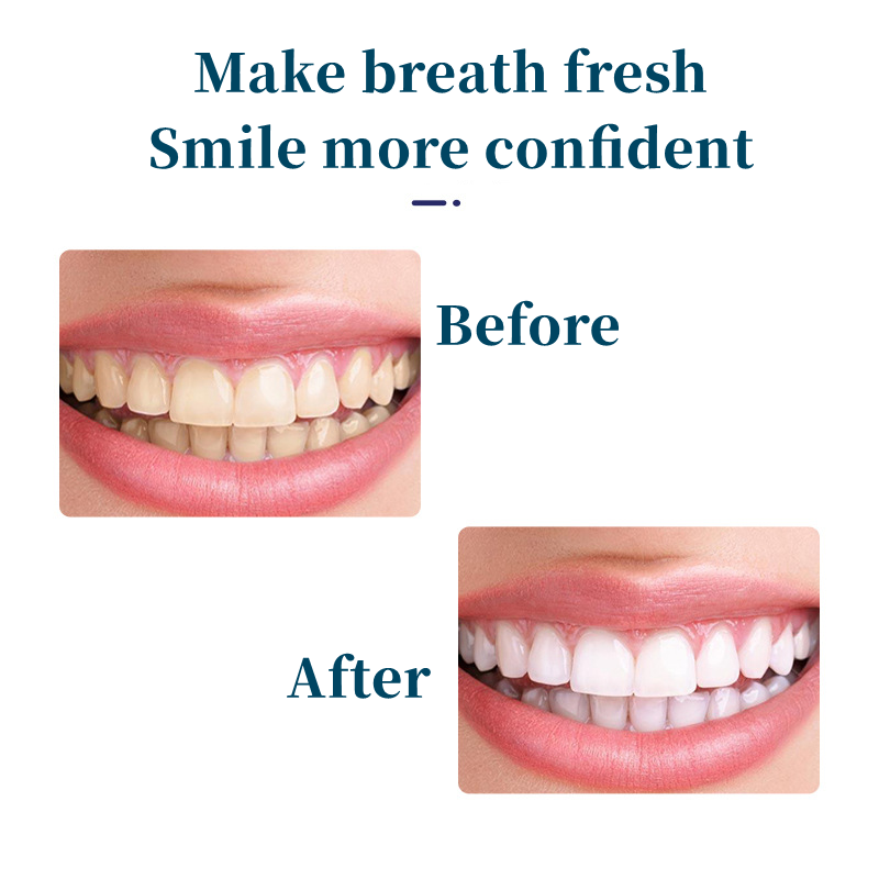 Probiotic Nicotinamide Dazzling White Toothpaste Protects Gums Freshens Breath