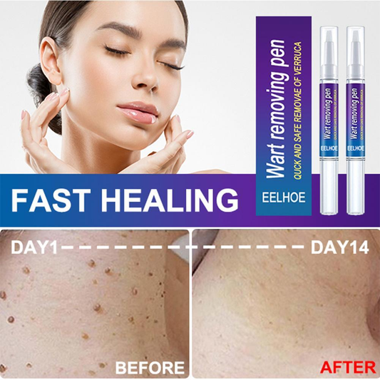 Wart Removing Against Moles Liquid Pen
