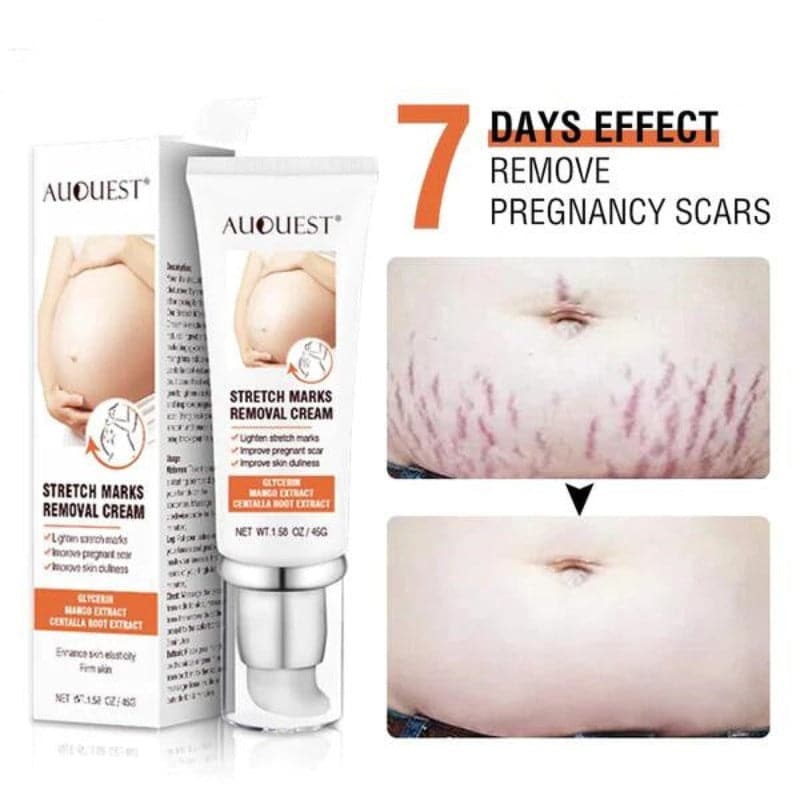 TikTok Maternity Stretch Marks Removal Cream Scar Remover Cream