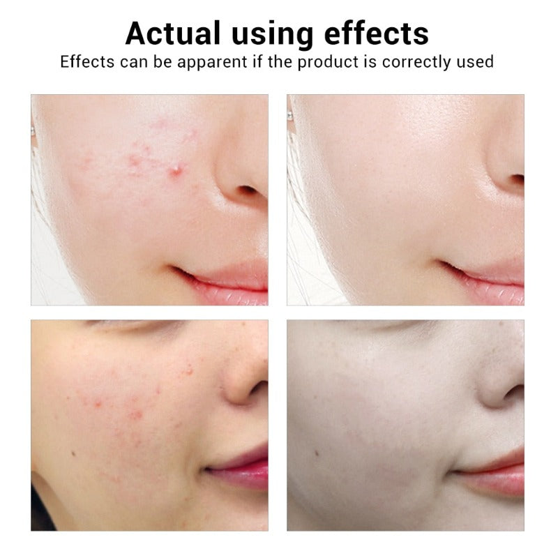 Whitening Essential Oil Niacinamide Anti-Aging Serum Repair Skin