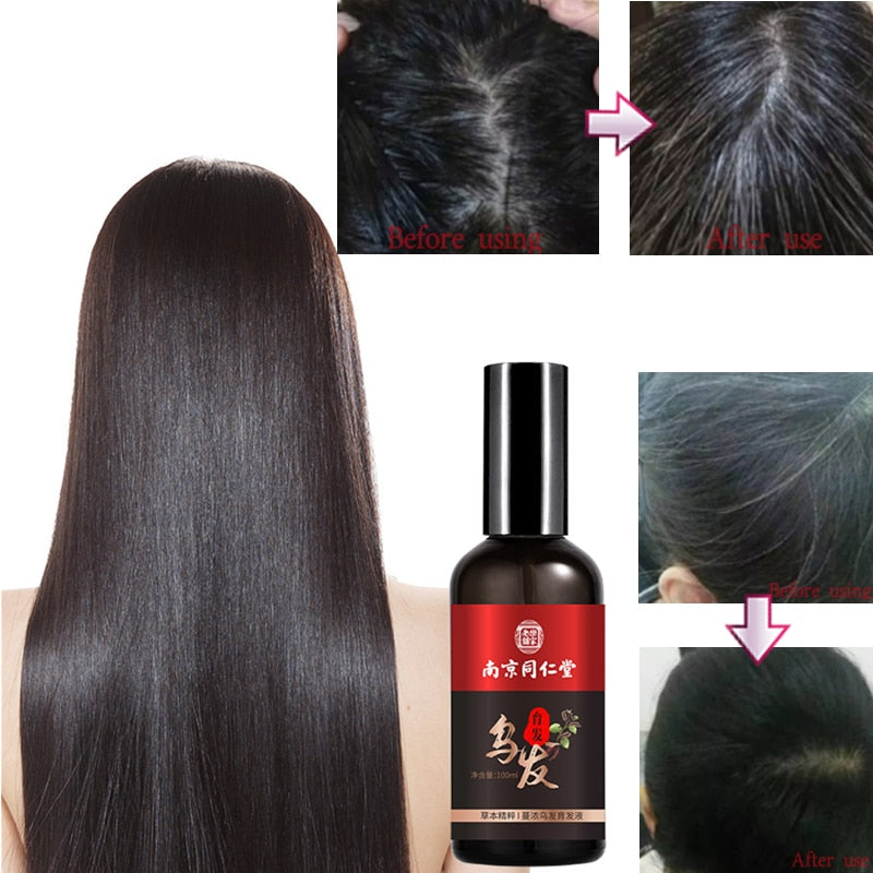 Hair Growth Nutrient Solution For Thinning Hair