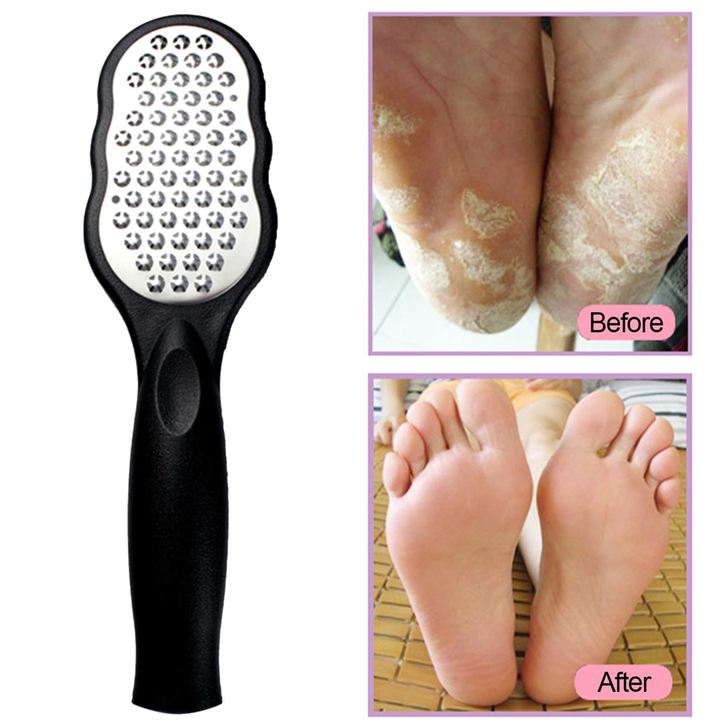Foot Files Stainless Steel Large Plate Pedicure Tools Foot Rasp for Callus