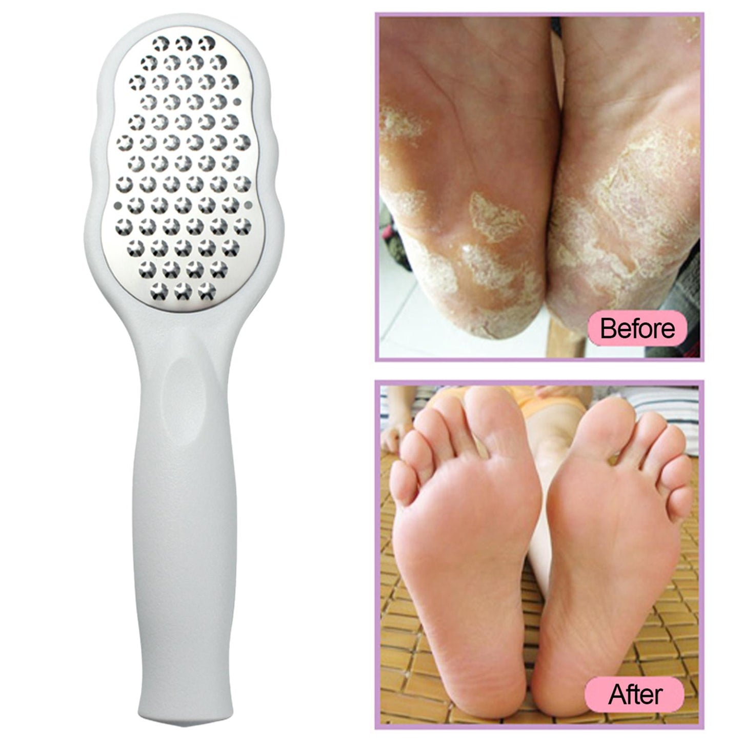 Foot Files Stainless Steel Large Plate Pedicure Tools Foot Rasp for Callus