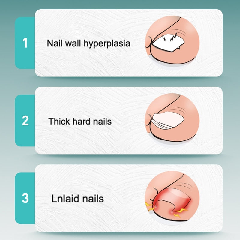 Professional Foot Scraper Toe Nail Shaver Dead Skin Remover