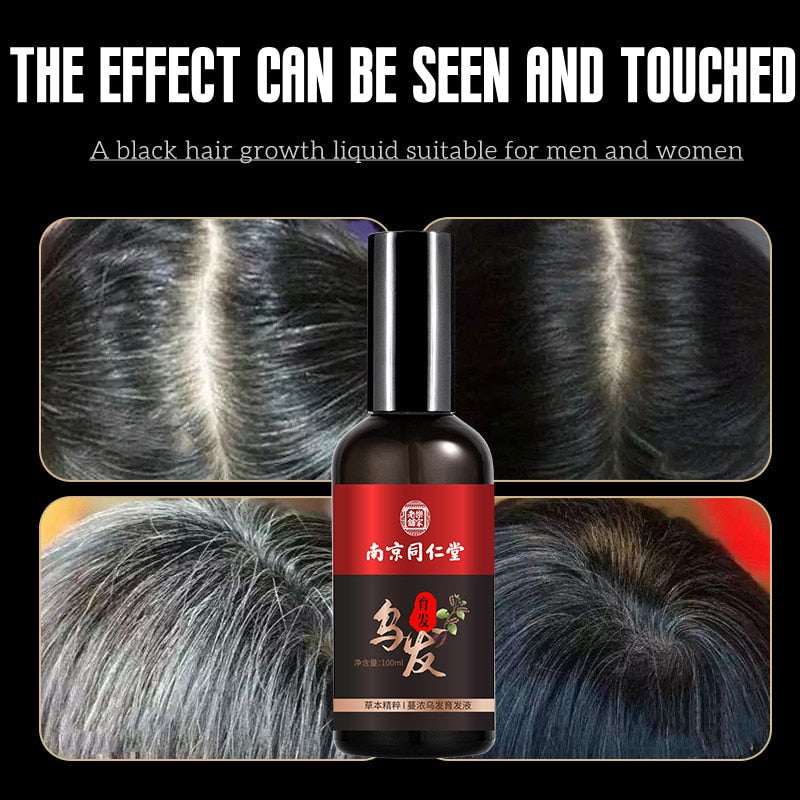 Hair Growth Nutrient Solution For Thinning Hair