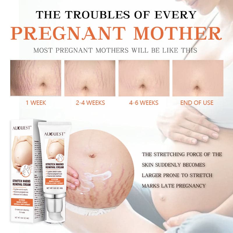 TikTok Maternity Stretch Marks Removal Cream Scar Remover Cream