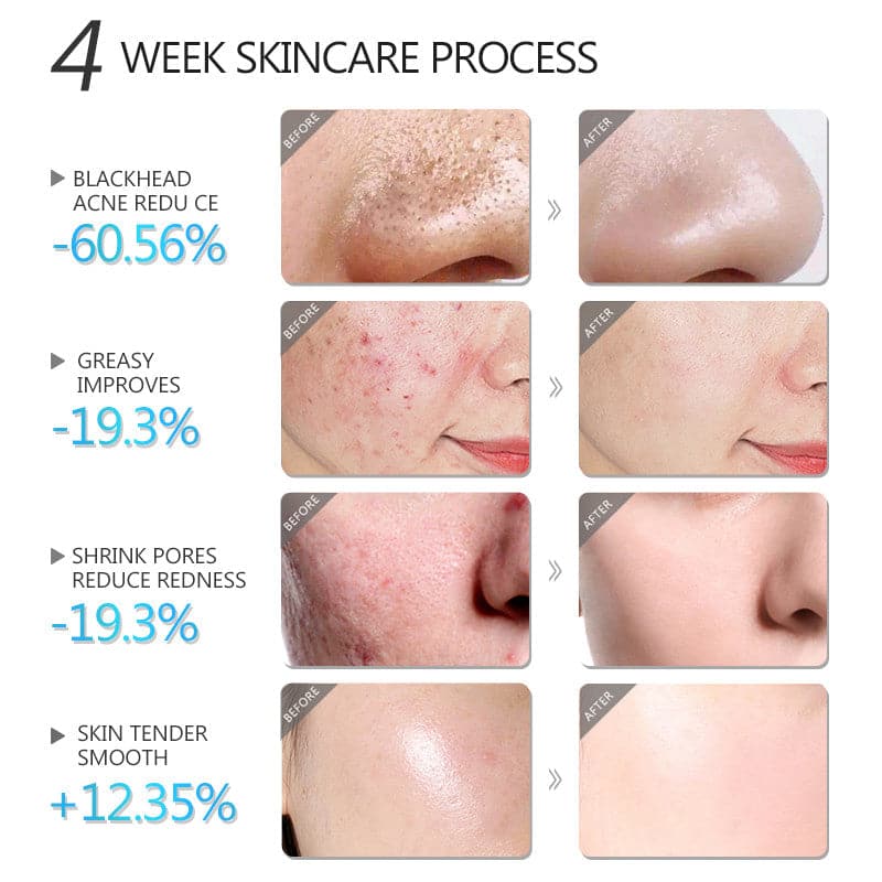 TikTok Facial Mask- Shrink Whitening Mask Face Skin Care