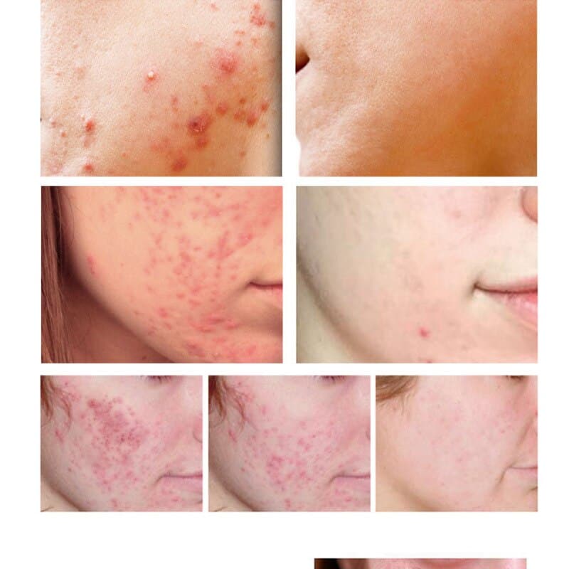 Shrink Pores Whitening Moisturizing Cream Skin Care