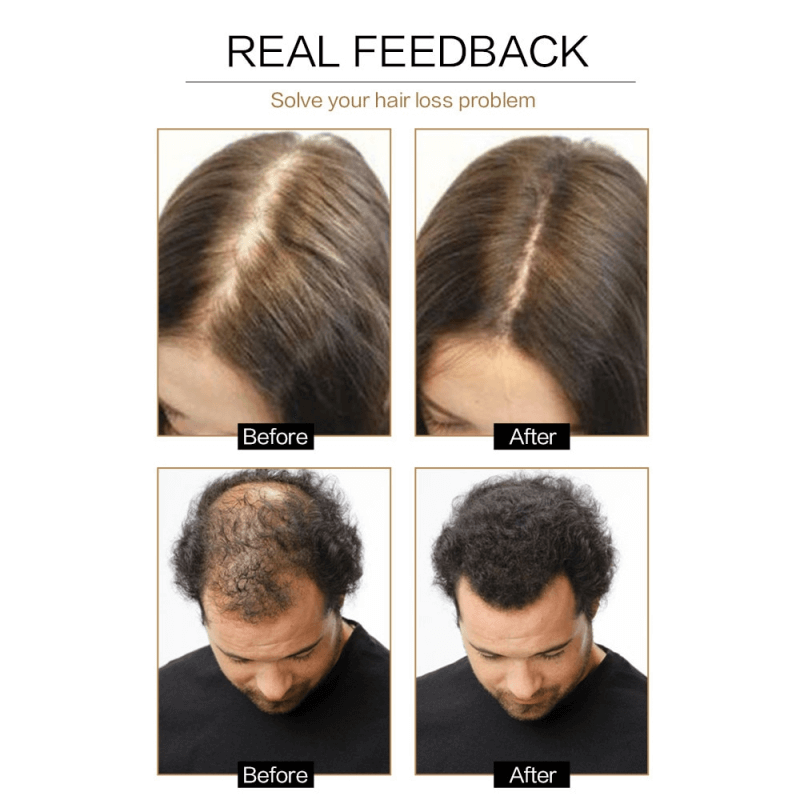 Hair Regrowth Anti-Hair Loss Oil Control Shampoo