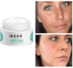 Whitening Freckle Cream  Dark Spots Face Moisturizing Dr.Hancy  Skin Care