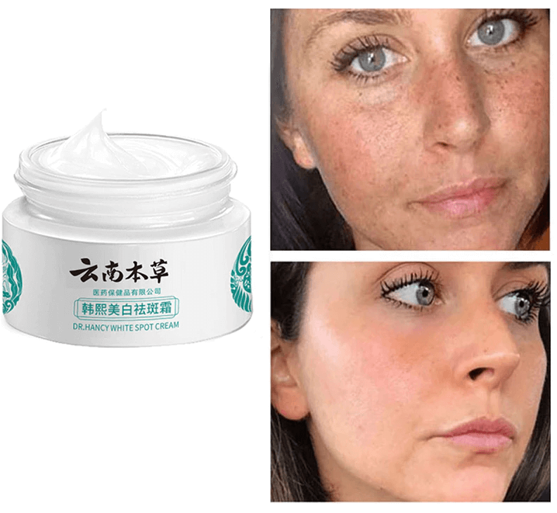 Whitening Freckle Cream  Dark Spots Face Moisturizing Dr.Hancy  Skin Care