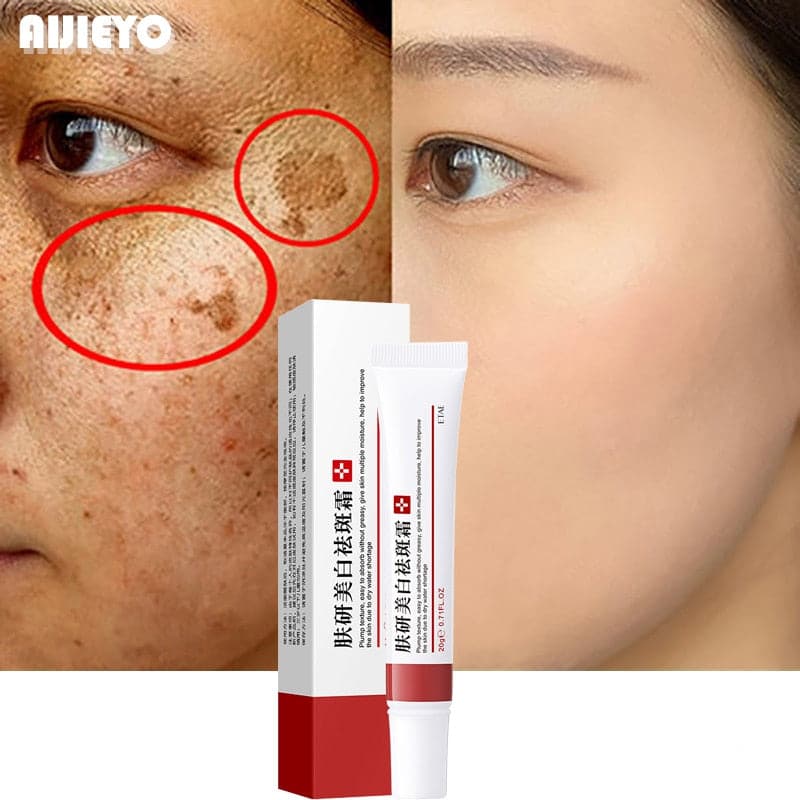 Skin Lightening Whitening Melasma Cream