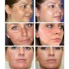 Shrink Pores Whitening Cream Oil Skin Face Treatment Moisturizing Care