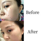Herbal Formula Ointment Skin Dark Spot Cleanup
