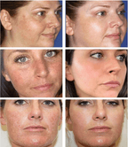Dr.Hancy Whitening Freckle Cream  Dark Spots Face Moisturizing Face Skin Care