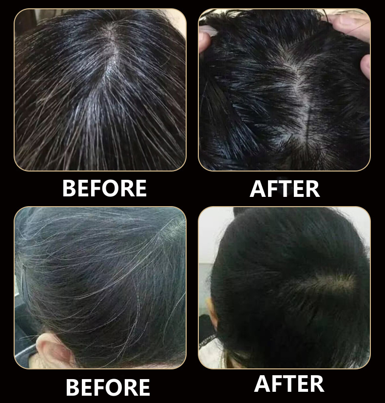 Hair Growth Nutrient Solution For Thinning Hair