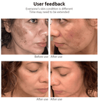 Dr.Hancy Whitening Freckle Cream  Dark Spots Face Moisturizing Face Skin Care