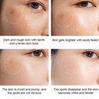 Dr.Hancy Whitening Freckle Cream  Dark Spots Face Moisturizing Face Skin Care