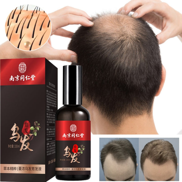 Hair Growth Nutrient Solution For Thinning Hair