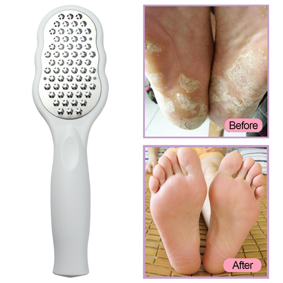 Foot Files Stainless Steel Large Plate Pedicure Tools Foot Rasp for Callus
