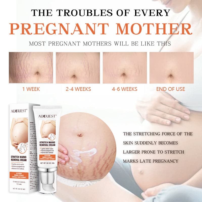 TikTok Maternity Stretch Marks Removal Cream   Scar Remover Cream