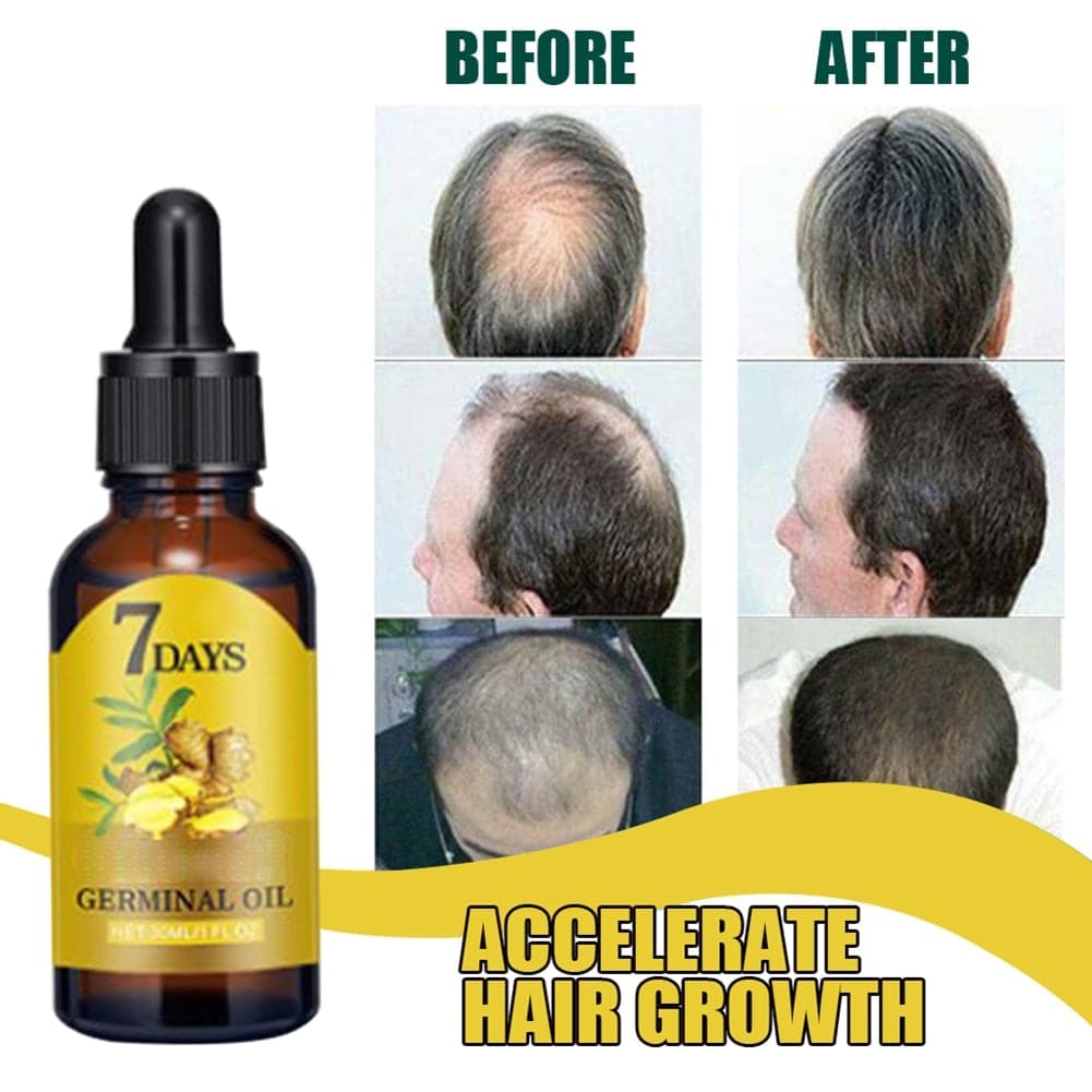 Ginger Hair Loss Treatment Strong the Root of Hair Serum