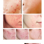 Shrink Pores Whitening Moisturizing Cream Skin Care